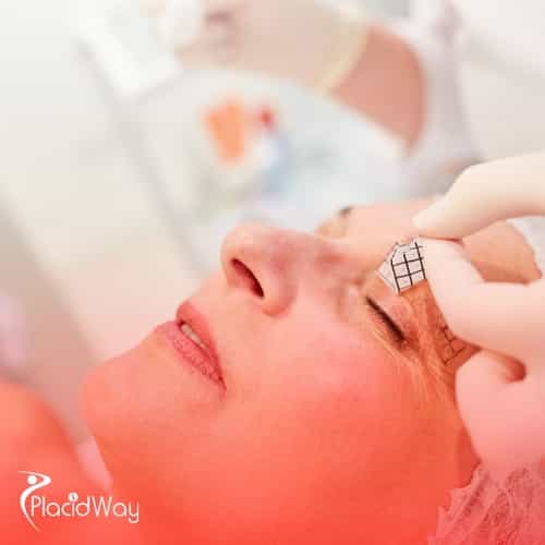 Eyelid Surgery in South Korea: Double Eyelid Surgery for U.S. Patients Seeking Affordable Solutions